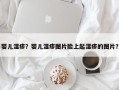 婴儿湿疹？婴儿湿疹图片脸上起湿疹的图片？
